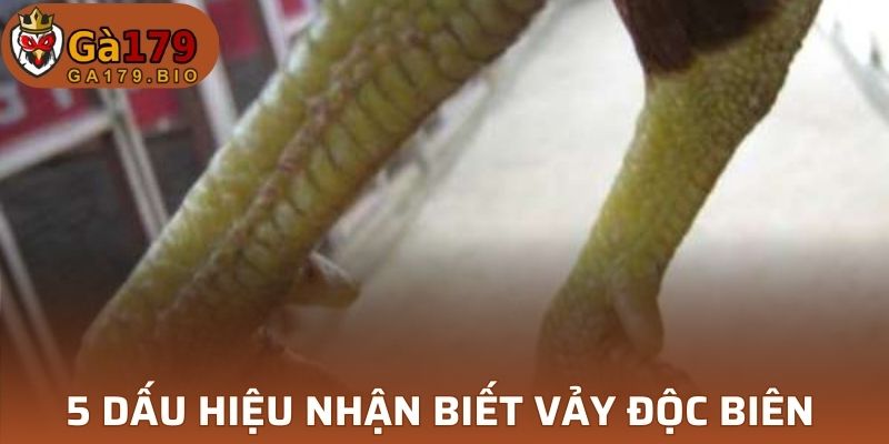 5 dấu hiệu nhận biết vảy Độc Biên