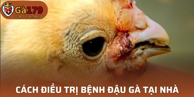 Cách điều trị bệnh đậu gà