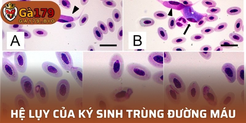 Hệ lụy nghiêm trọng của bệnh ký sinh trùng đường máu